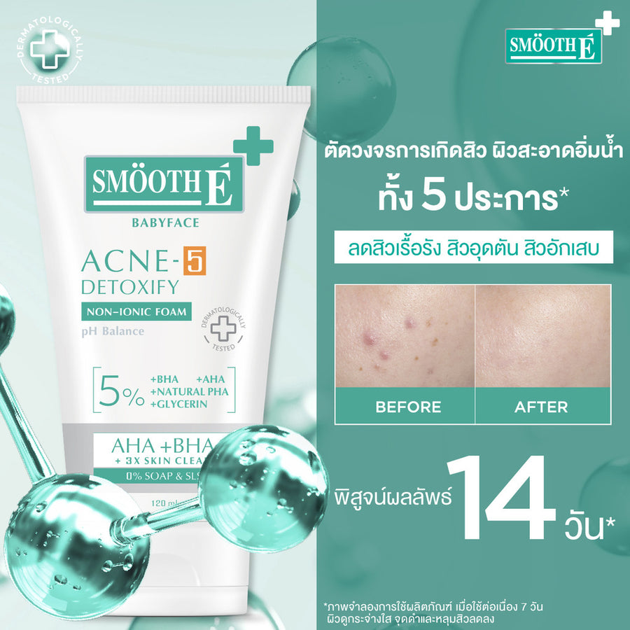 Smooth E Acne-5 Whitening Set