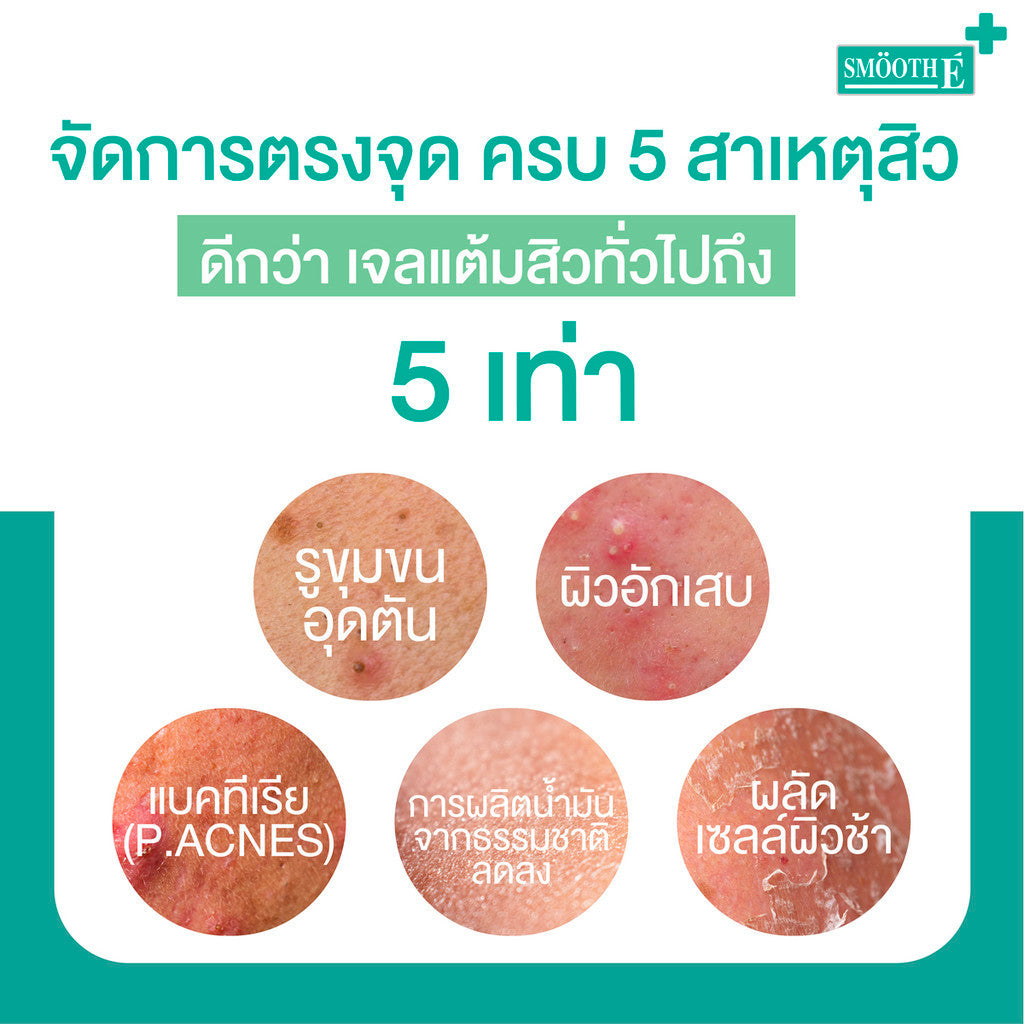 Smooth E Acne Recovery Set