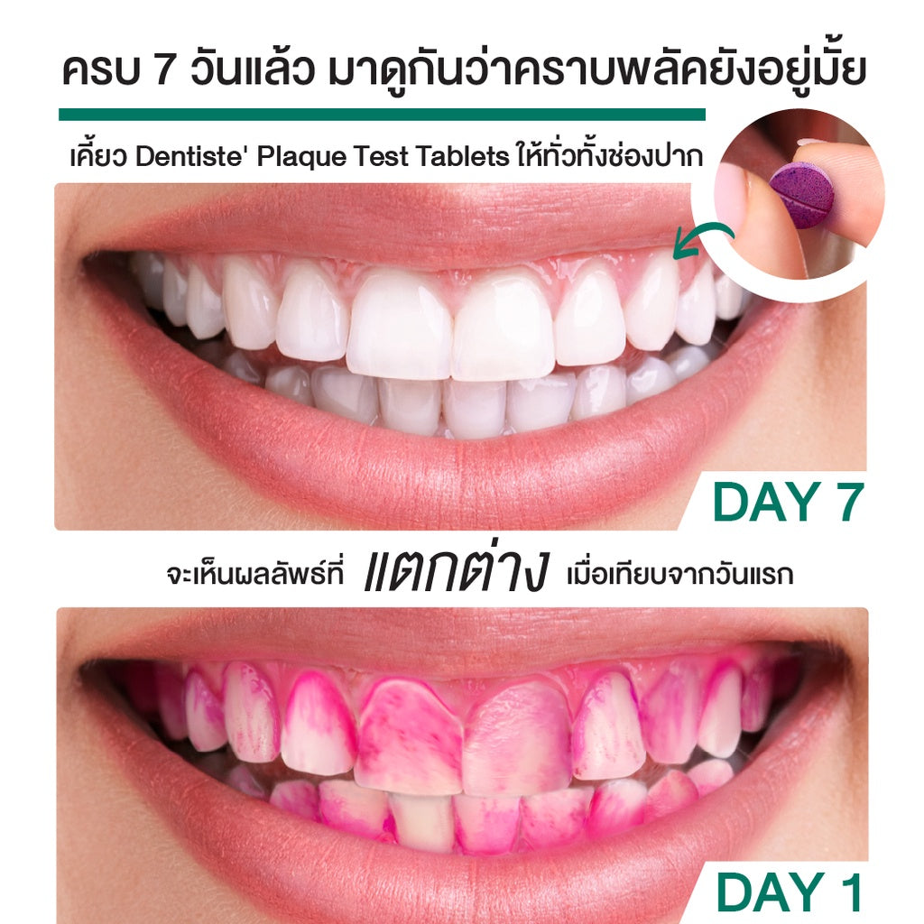 Dentiste PLAQUE TEST TABLETS 10S