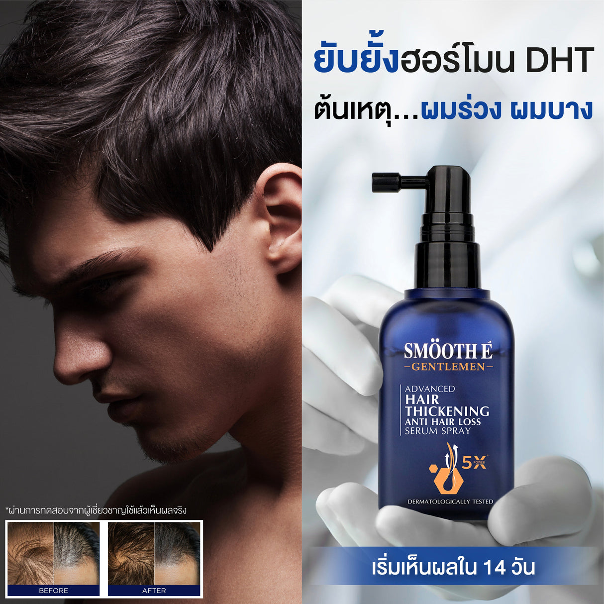 Smooth E Gentlemen Advanced Hair Thickening Anti Hair Loss Serum Spray