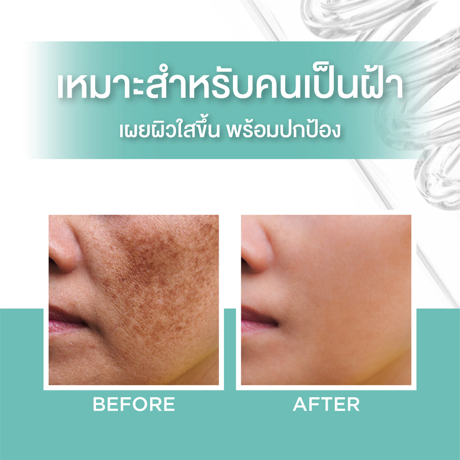 Smooth E Anti-Melasma White Babyface Serum Plus SPF44