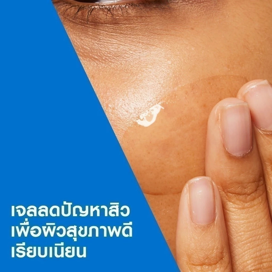 CERAVE BLEMISH CONTROL GEL เซราวี ผลิตภัณฑ์บำรุงผิวหน้า สูตรสำหรับผิวเป็นสิวง่าย 40 มล.