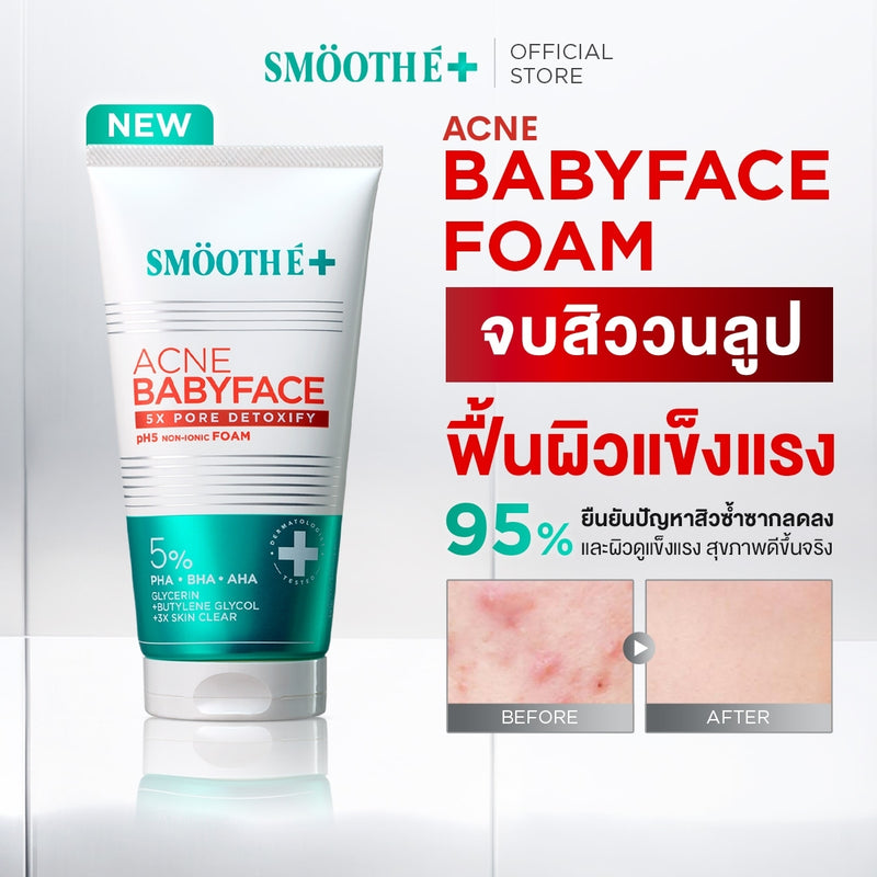 [NEW] SMOOTHE BABYFACE ACNE-5 DETOXIFY NON-IONIC FOAM