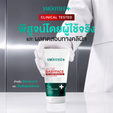 [Pre-Order] SMOOTHE BABYFACE ACNE-5 DETOXIFY NON-IONIC FOAM