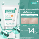 Smooth E Acne-5 Whitening Set