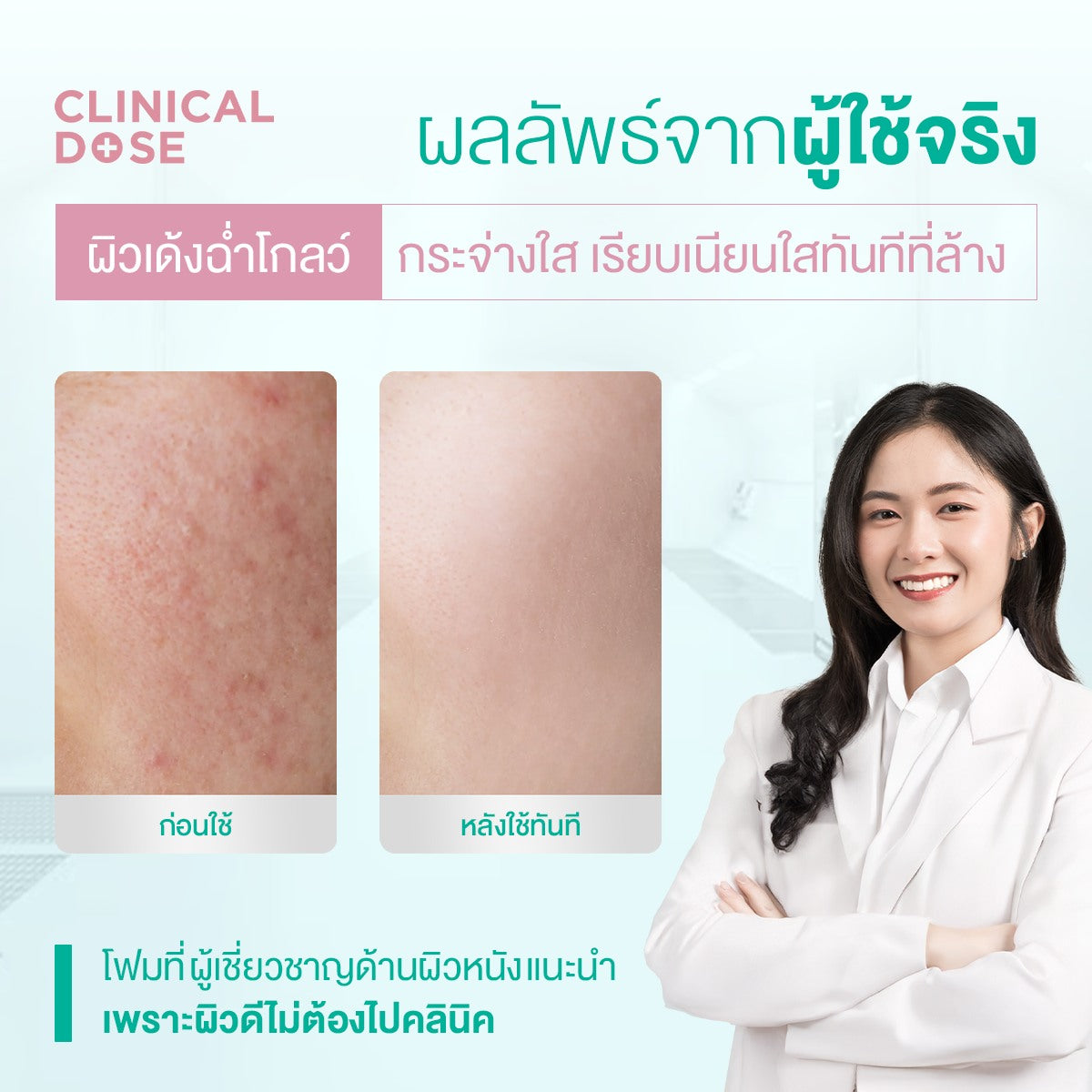 [Pack 6] Smooth E White Babyface Spot Clear 180 ml.