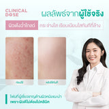 [Pack 6] Smooth E White Babyface Spot Clear 180 ml.