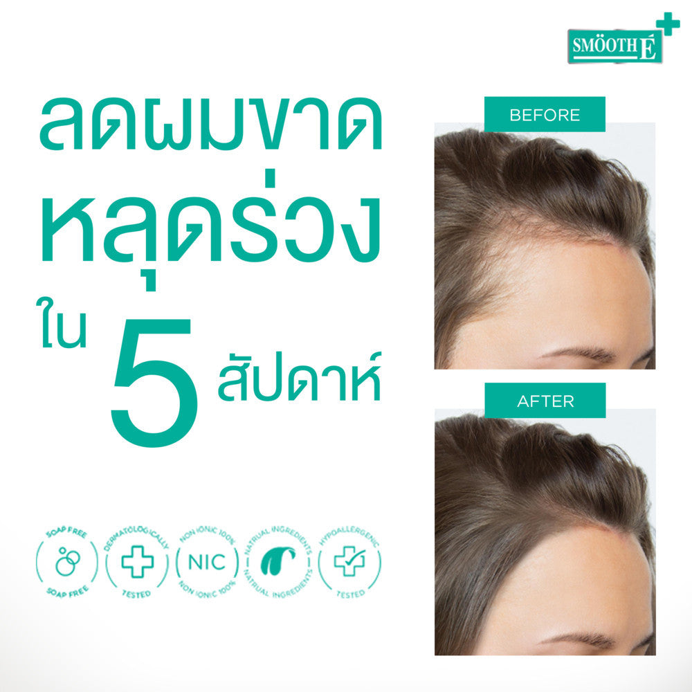 [1 Free 1] Smooth E Gentlemen Anti Hair Loss Serum Spray 50 ml. Free Smooth Life HSN 7 tab