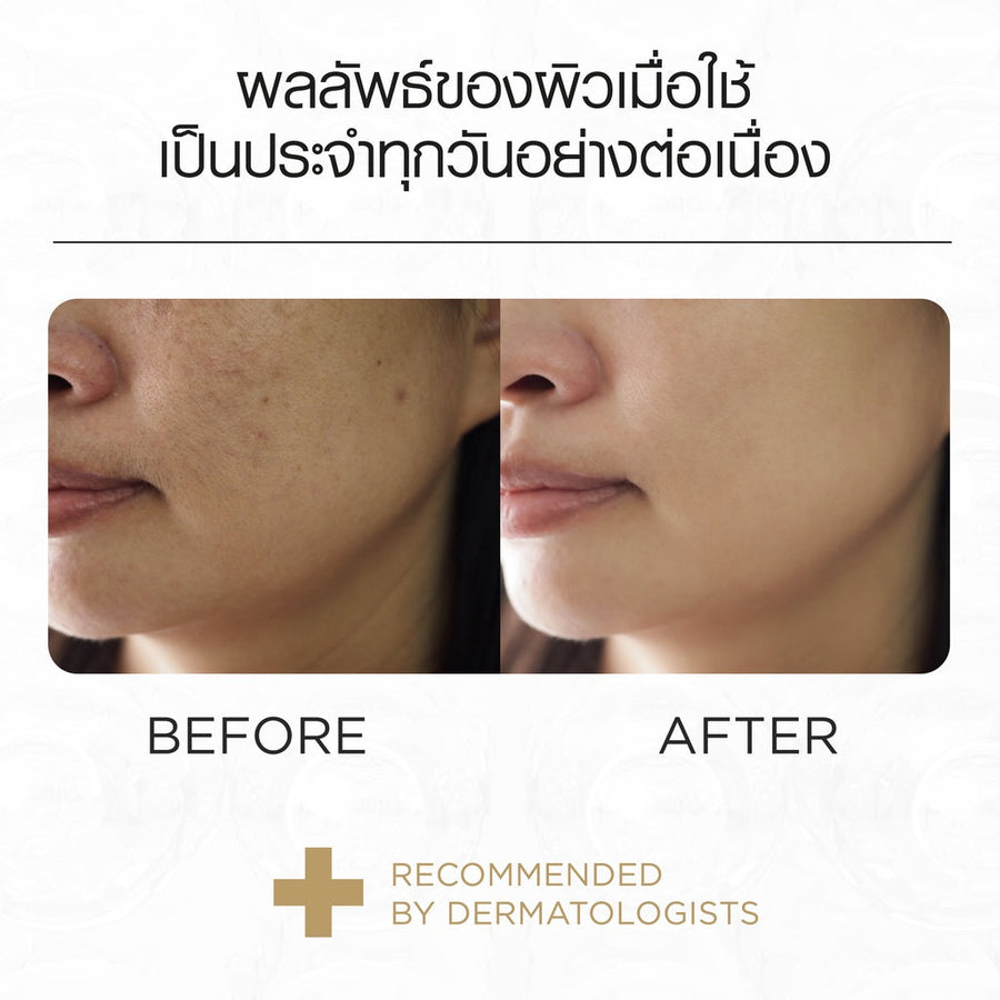 [Free Gift] Smooth E Gold Capsule 5S