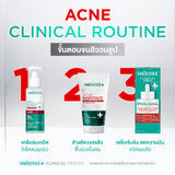 [Pre-Order] SMOOTHE BABYFACE ACNE-5 DETOXIFY NON-IONIC FOAM