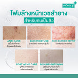 Smooth E Acne-5 Whitening Set