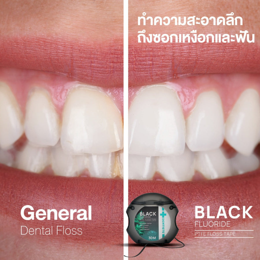 [Mid-Year Sale] Dentiste Dental Black PTFE Floss Tape with Fluoride 30m