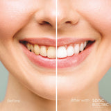 [1 free 2] Dentiste Sonic Electronic Toothbrush 5 Mode  free Extra Fresh Spray 3 ml & Plaque Test 10s.