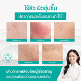 [3-Month Subscription] Smooth E Daily Bright Smile Set