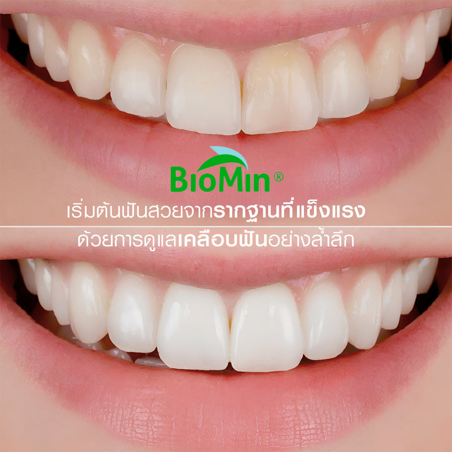 [2 Free 4] Dentiste' Remin Fluoride 15 g. & Repaire X3 70 g. Free! Toothbrush x3 & Magic Brush x1