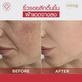 Smooth E Ultimate Glow & Lift Set
