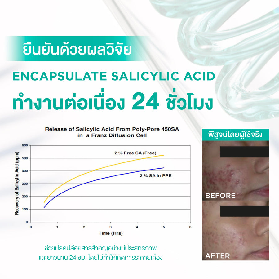 [Mid-Year Sale] Smooth E Acne-5 Rapid Action Plus