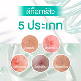 [Mid-Year Sale] Smooth E Babyface Acne-5 Detoxify Non-Ionic Foam