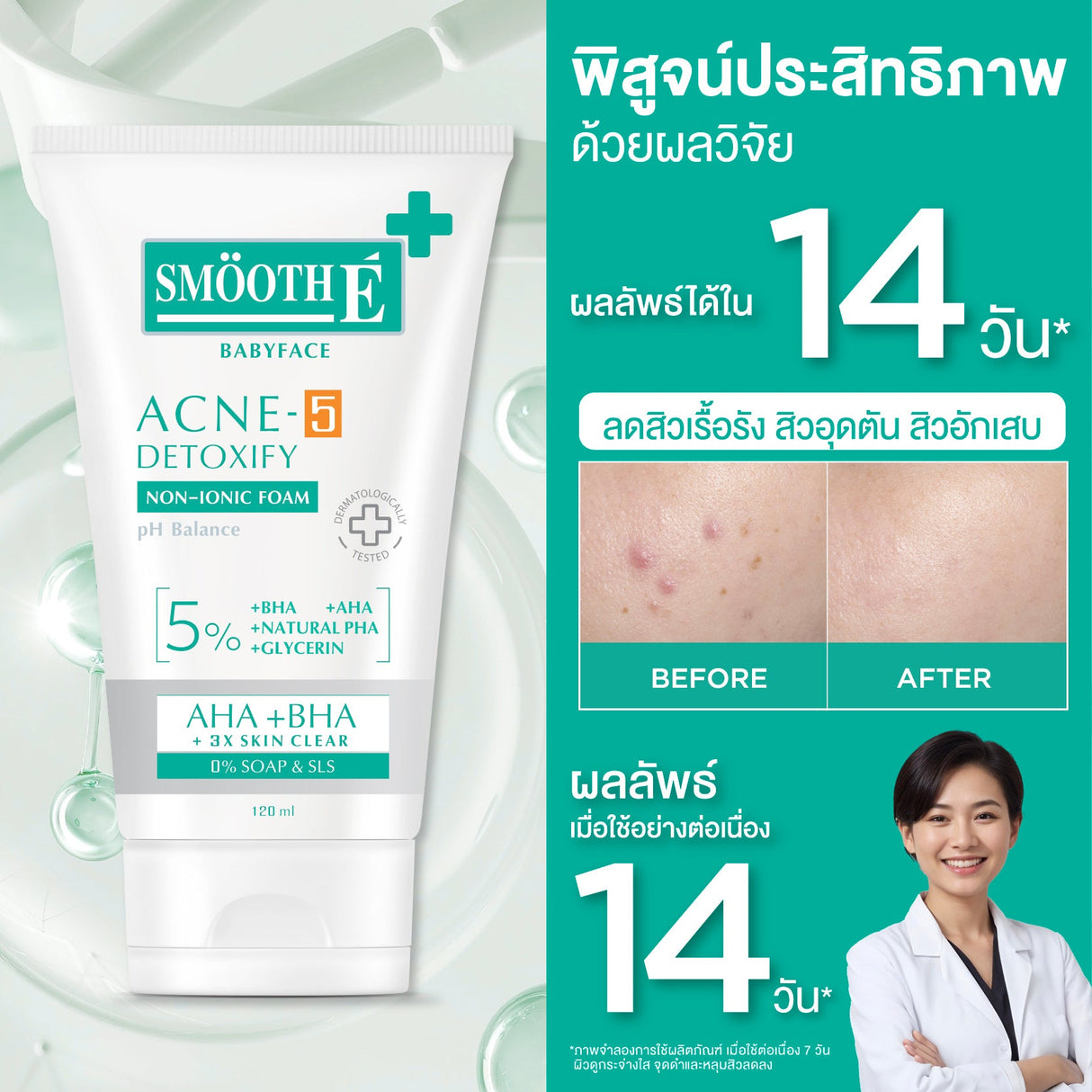 [Mid-Year Sale] Smooth E Babyface Acne-5 Detoxify Non-Ionic Foam