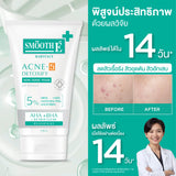 [Mid-Year Sale] Smooth E Babyface Acne-5 Detoxify Non-Ionic Foam