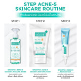 Smooth E Acne-5 Clear Makeup Cleansing Water