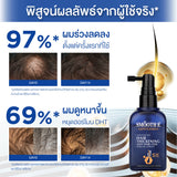 [1 Free 1] Smooth E Gentlemen Anti Hair Loss Serum Spray 50 ml. Free Anti Hair Loss Shampoo 75 ml.