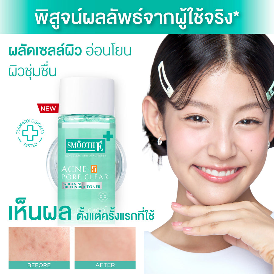 [Mid-Year Sale] Smooth E Acne-5 Pore Clear Whitening Toner