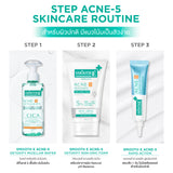 [Mid-Year Sale] Smooth E Babyface Acne-5 Detoxify Non-Ionic Foam