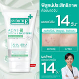 Smooth E Acne-5 Detox & Moisture Extra Sensitive Cleansing Gel