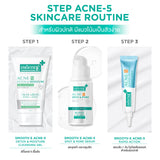 Smooth E Acne-5 Detox & Moisture Extra Sensitive Cleansing Gel