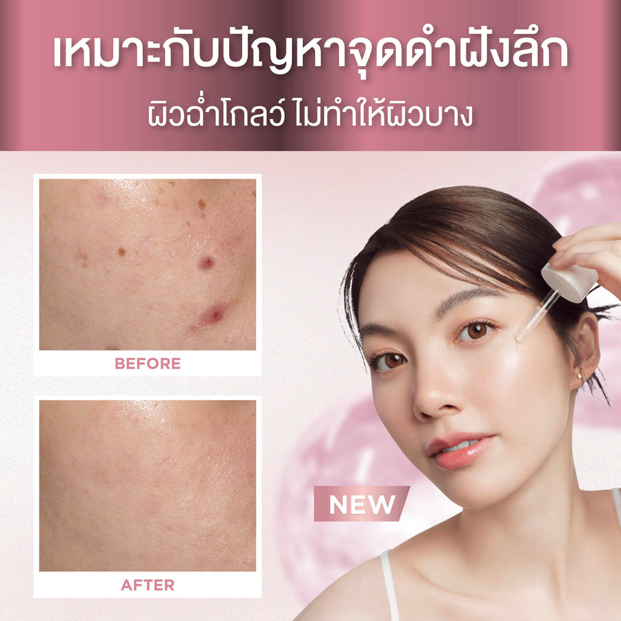 [Duo Deal] Smooth E Sun ZERO Feel Protection 30 g. & Smooth E Serum 13 g.