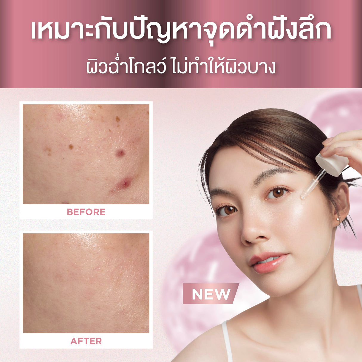 [NEW] Smooth E Sun ZERO Feel Protection 30 g. & Smooth E White Babyface Spot Clear 80 ml. & Smooth E Serum 13 g.