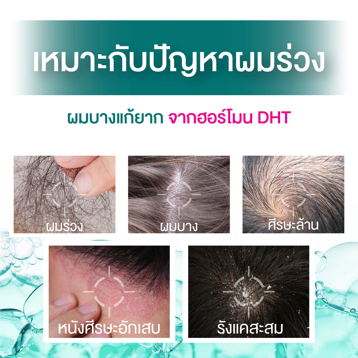 [1 Free 1] Smooth E Gentlemen Anti Hair Loss Serum Spray 50 ml. Free Anti Hair Loss Shampoo 75 ml.
