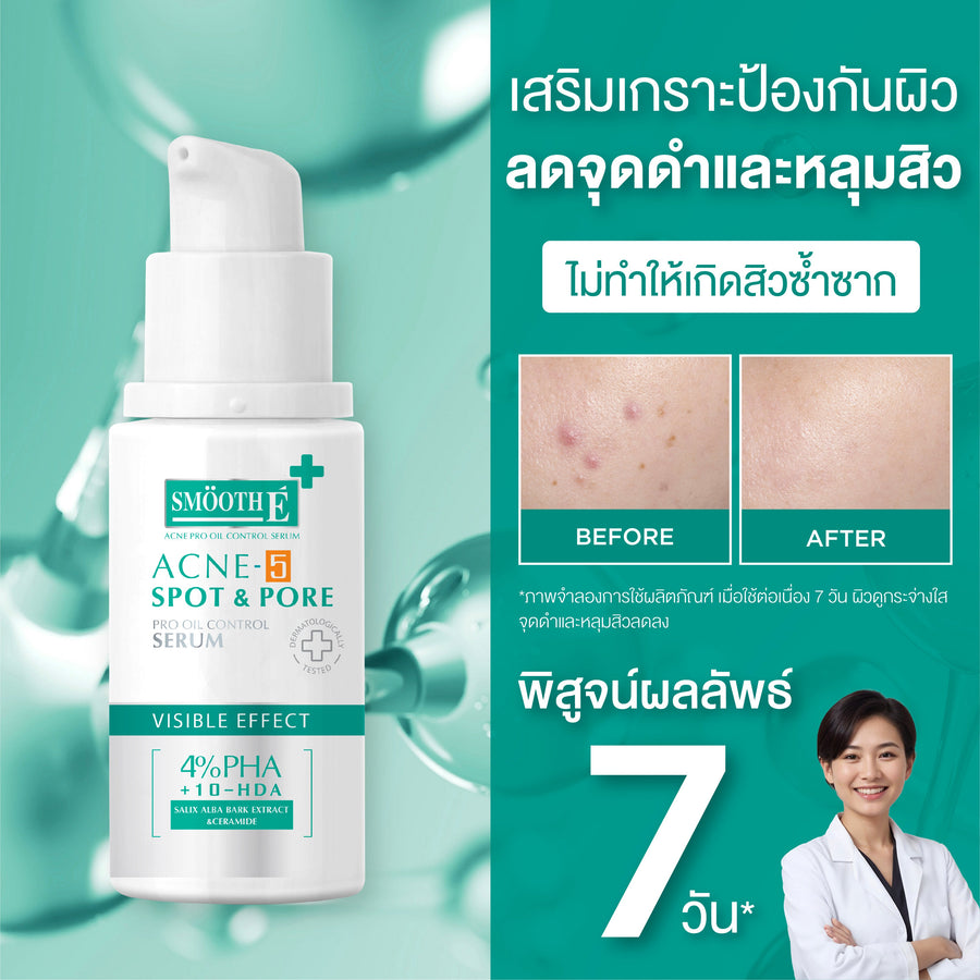 [Mid-Year Sale] Smooth E Acne-5 SPOT & PORE SERUM
