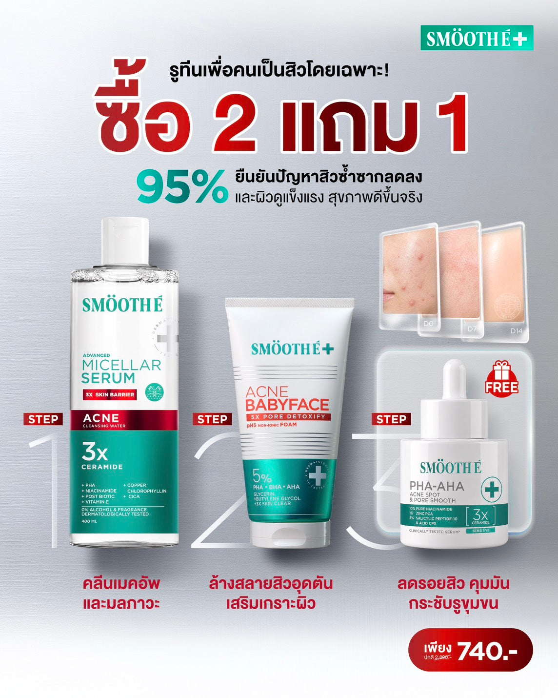 [Buy 2 Get 1] Smooth E Micellar Serum Acne Cleansing Water 400 ml.