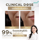 SMOOTH E RETINAL PLUS DEEP WRINKLE REPAIR 30 G.